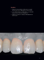 Soft Tissues & Pink Esthetics in Implant Therapy - Image 6