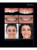 Soft Tissues & Pink Esthetics in Implant Therapy - Image 7