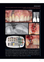 Soft Tissues & Pink Esthetics in Implant Therapy - Image 9