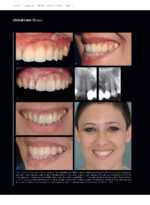 Soft Tissues & Pink Esthetics in Implant Therapy - Image 10