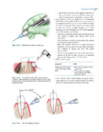 Local Anesthesia in Dentistry 2024 - Image 14