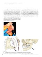 Advanced Craniomaxillofacial Surgery 2020 - Image 5