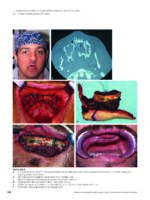 Advanced Craniomaxillofacial Surgery 2020 - Image 6