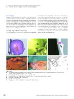 Advanced Craniomaxillofacial Surgery 2020 - Image 8