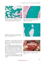 Bone and Soft Tissue Augmentation in Implantology 2022 - Image 3