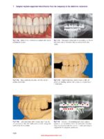 Bone and Soft Tissue Augmentation in Implantology 2022 - Image 5