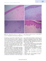 Clinicopathological Correlation of Oral Diseases 2023 - Image 6