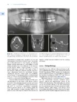 Clinicopathological Correlation of Oral Diseases 2023 - Image 5
