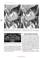 Clinicopathological Correlation of Oral Diseases 2023 - Image 3