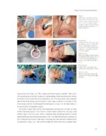 Introduction to Contemporary Orthognathic Surgery 2024 - Image 4