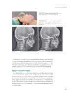 Introduction to Contemporary Orthognathic Surgery 2024 - Image 5