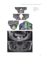 Introduction to Contemporary Orthognathic Surgery 2024 - Image 6