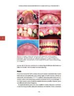 Management of Endodontic Complications From Diagnosis to Prognosis 2023 - Image 4