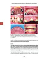 Management of Endodontic Complications From Diagnosis to Prognosis 2023 - Image 4