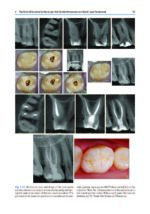 Minimally Invasive Approaches in Endodontic Practice 2021 - Image 9