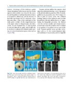 Minimally Invasive Approaches in Endodontic Practice 2021 - Image 10