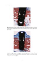 Osseointegrated Oral implants 2020 - Image 4