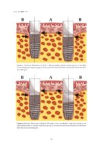 Osseointegrated Oral implants 2020 - Image 5