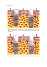 Osseointegrated Oral implants 2020 - Image 5
