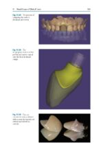 Partial Extraction Therapy in Implant Dentistry 2020 - Image 3