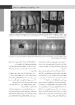 پريودنتولوژی بالينی كارانزا  2024 جلد اول - Image 17