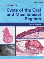 Shear's Cysts of the Oral and Maxillofacial Regions 2022