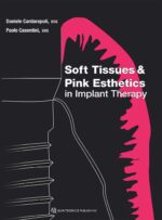 Soft Tissues & Pink Esthetics in Implant Therapy