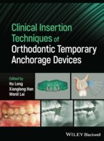 Clinical Insertion Techniques of Orthodontic Temporary Anchorage 2024