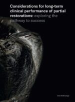 Considerations for long term clinical performance of partial restorations 2023