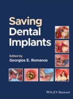 Saving Dental Implants 2024