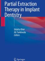 Partial Extraction Therapy in Implant Dentistry 2020