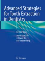 Advanced Strategies for Tooth Extraction in Dentistry 2024