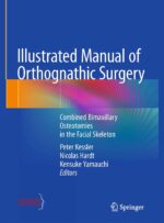 Illustrated Manual of Orthognathic Surgery 2024