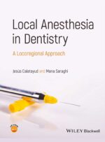 Local Anesthesia in Dentistry 2024