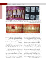 پريودنتولوژی بالينی كارانزا  2024 جلد اول - Image 5