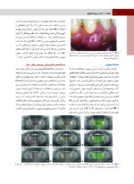 پريودنتولوژی بالينی كارانزا  2024 جلد اول - Image 6