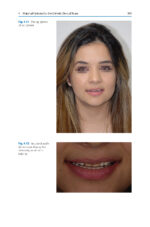 Esthetic Oral Rehabilitation with Veneers A Guide to Treatment Preparation 2020 - Image 3