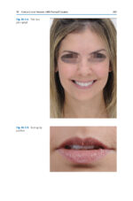 Esthetic Oral Rehabilitation with Veneers A Guide to Treatment Preparation 2020 - Image 9