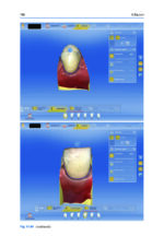 Esthetic Oral Rehabilitation with Veneers A Guide to Treatment Preparation 2020 - Image 13