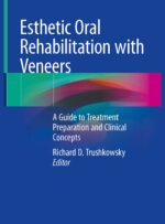 Esthetic Oral Rehabilitation with Veneers A Guide to Treatment Preparation 2020