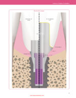 Implant Prosthodontics Protocols and Techniques for Fixed Implant Restorations 2022 - Image 2
