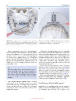 Minimally Invasive (MI) Orthognathic Surgery 2023 - Image 9