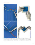 Periodontal and Peri-implant Plastic Microsurgery 2021 - Image 9