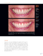 Periodontal and Peri-implant Plastic Microsurgery 2021 - Image 7
