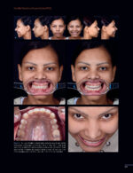 Periodontal and Peri-implant Plastic Microsurgery 2021 - Image 6