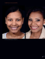 Periodontal and Peri-implant Plastic Microsurgery 2021 - Image 5