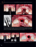 Periodontal and Peri-implant Plastic Microsurgery 2021 - Image 3