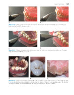Power Instrumentation for the Dental Professional 2023 - Image 9