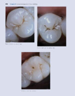 Power Instrumentation for the Dental Professional 2023 - Image 10