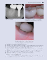 Power Instrumentation for the Dental Professional 2023 - Image 12